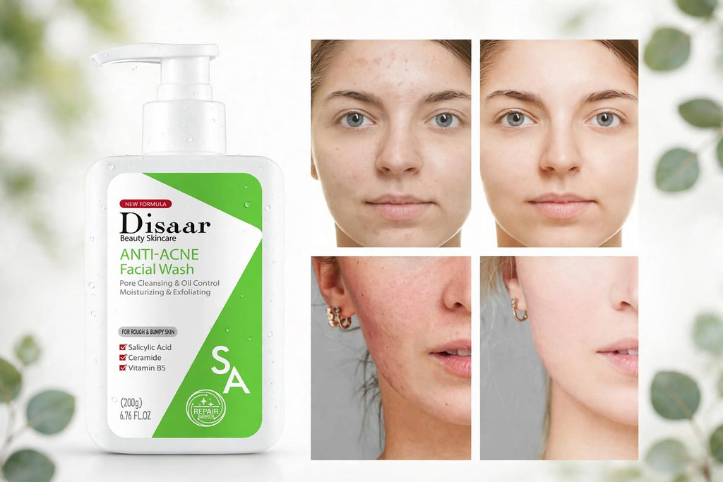 Kit Aclarador + Anti-Acné: Aceite Zanahoria y Limpiador Salicílico - Pack 2 (MÁS POPULAR)